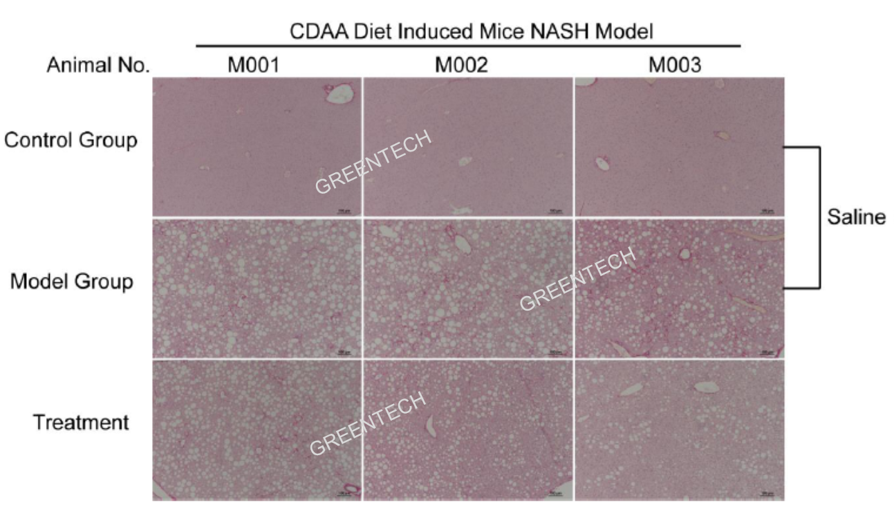 CADD饲料诱导NASH小鼠模型的肝脏组织病理学特征