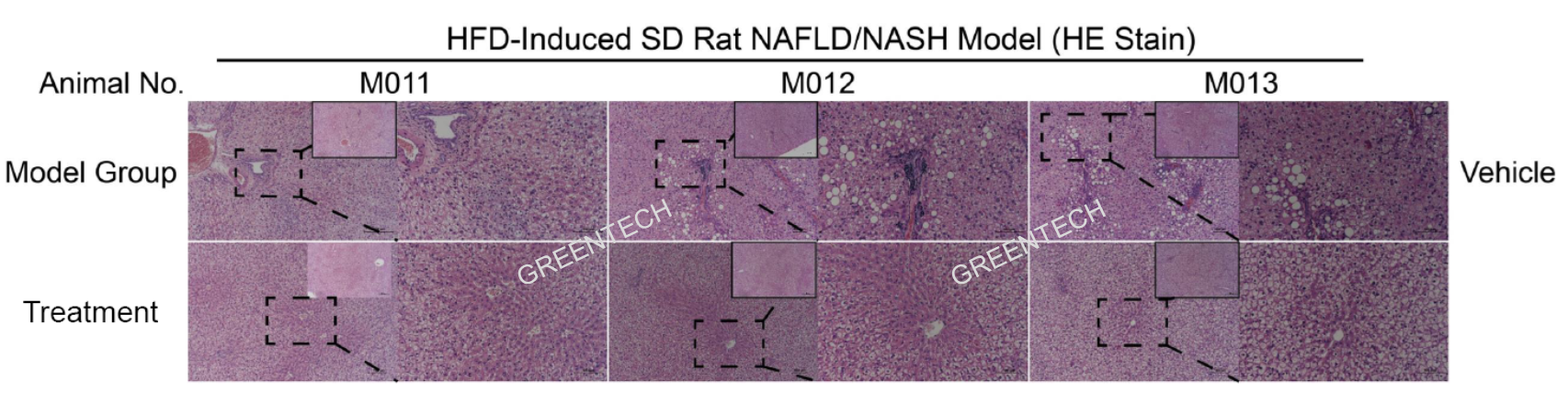 HFD饲料诱导12周后NASH动物模型的肝脏组织病理学（H&E染色）