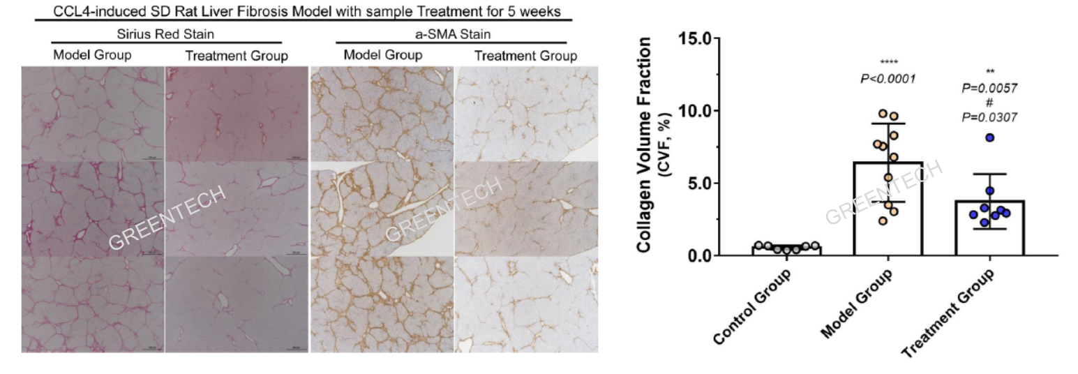 CCl4诱导8周后肝纤维化模型的肝脏纤维化进程胶原容积分数