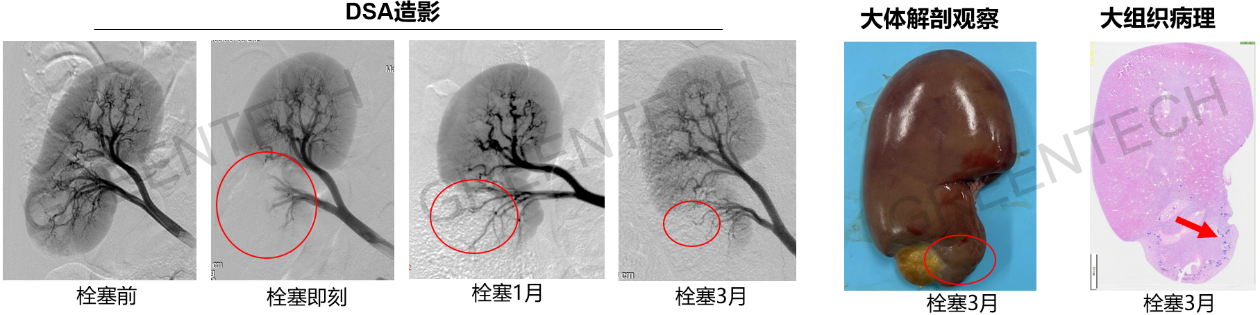 大白猪肾下极动脉栓塞.png